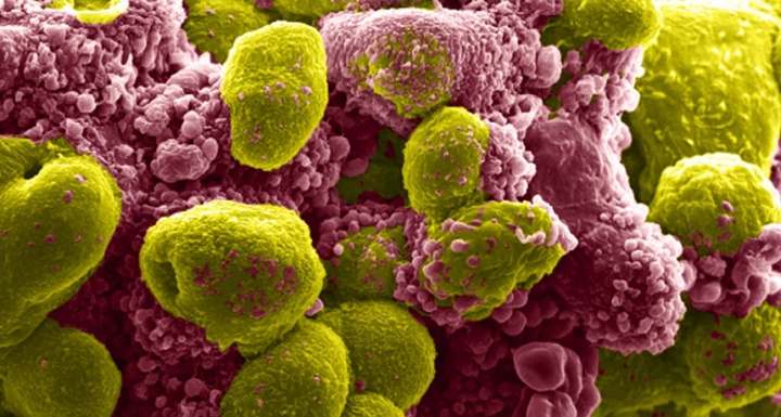 Células em apoptose